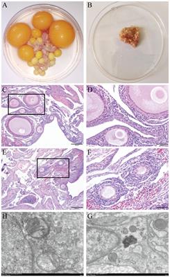 Whole transcriptome analysis revealed the regulatory network and related pathways of non-coding RNA regulating ovarian atrophy in broody hens